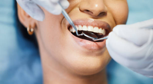 Best Emergency Root Canal Treatment in Spring Hill, KS