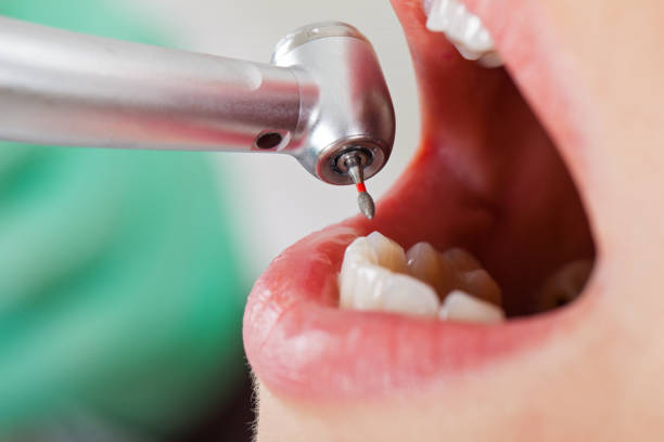 Best Same-Day Emergency Dentist in Spring Hill, KS